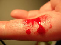 bleeding fingers